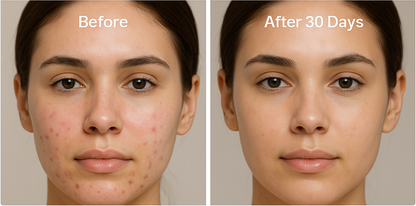 Aurelle Therapy Mask